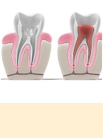 endodonzia